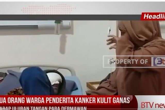 DUA ORANG WARGA PENDERITA KANKER KULIT GANAS HARAP ULURAN TANGAN PARA DERMAWAN